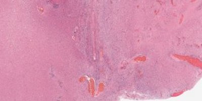 TCGA-02-0010-01Z-00-DX4.07de2e55-a8fe-40ee-9e98-bcb78050b9f7